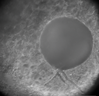 Microscopy image of a cardiac organoid